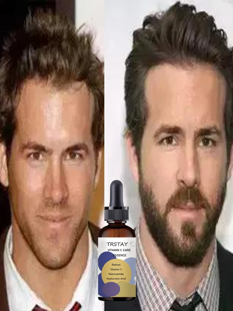 Top Beard Oils for Men to Boost Growth and Soften Coarse Facial Hair