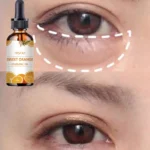 Effective Eye Hydrating Oil Review for Reducing Dark Circles and Puffiness