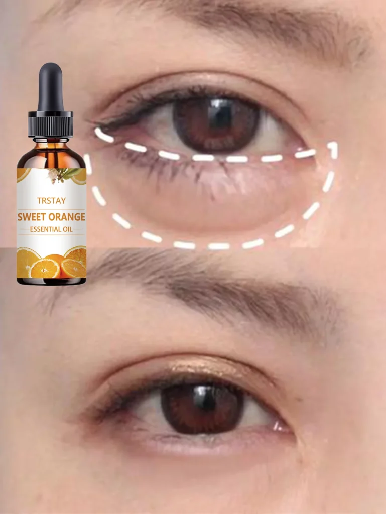 Effective Eye Hydrating Oil Review for Reducing Dark Circles and Puffiness