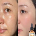 Top Benefits of Using Alcohol-Free Facial Oils for Hydrated, Radiant Skin