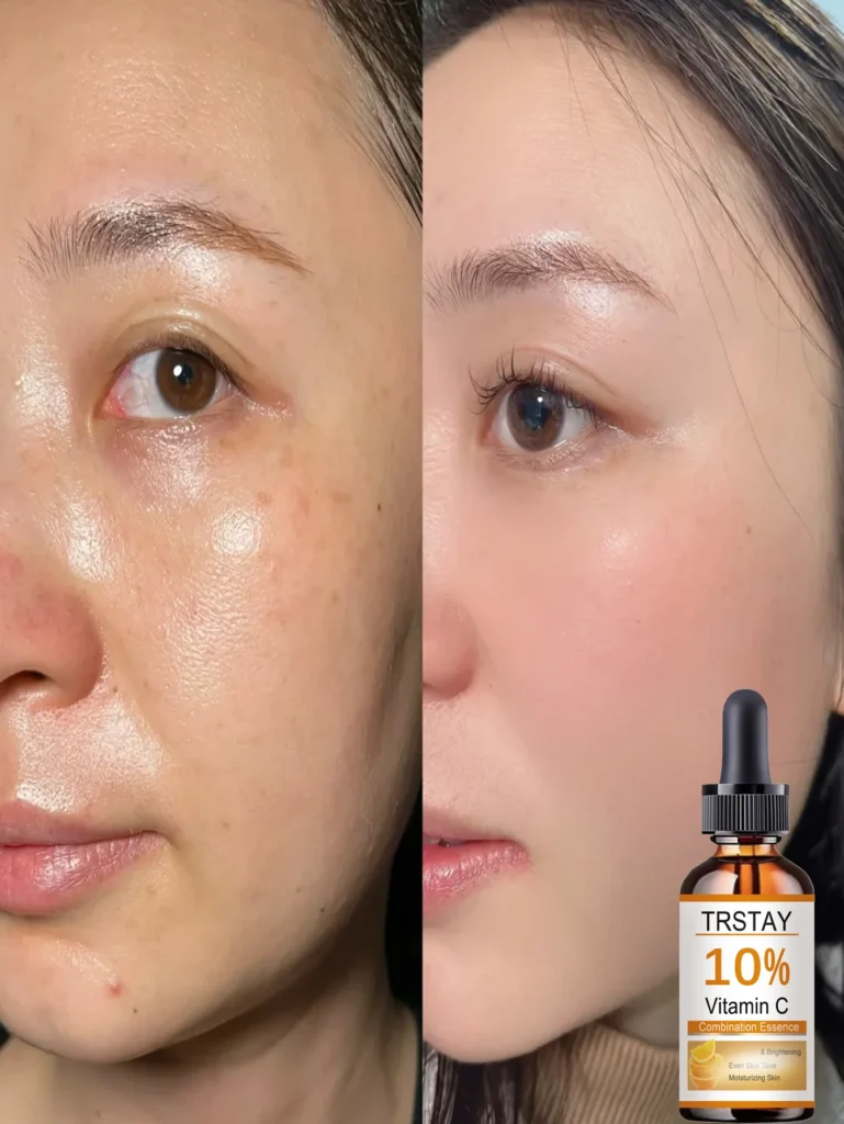 Top Benefits of Using Alcohol-Free Facial Oils for Hydrated, Radiant Skin