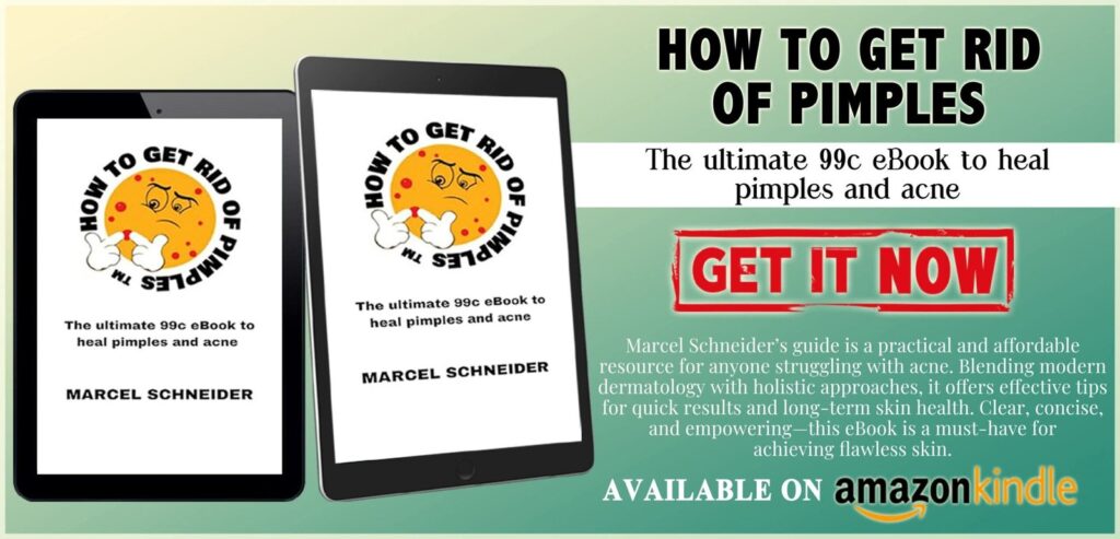 🌟 Say Goodbye to Pimples Forever with HowToGetRidOfPimples™! 🌟   